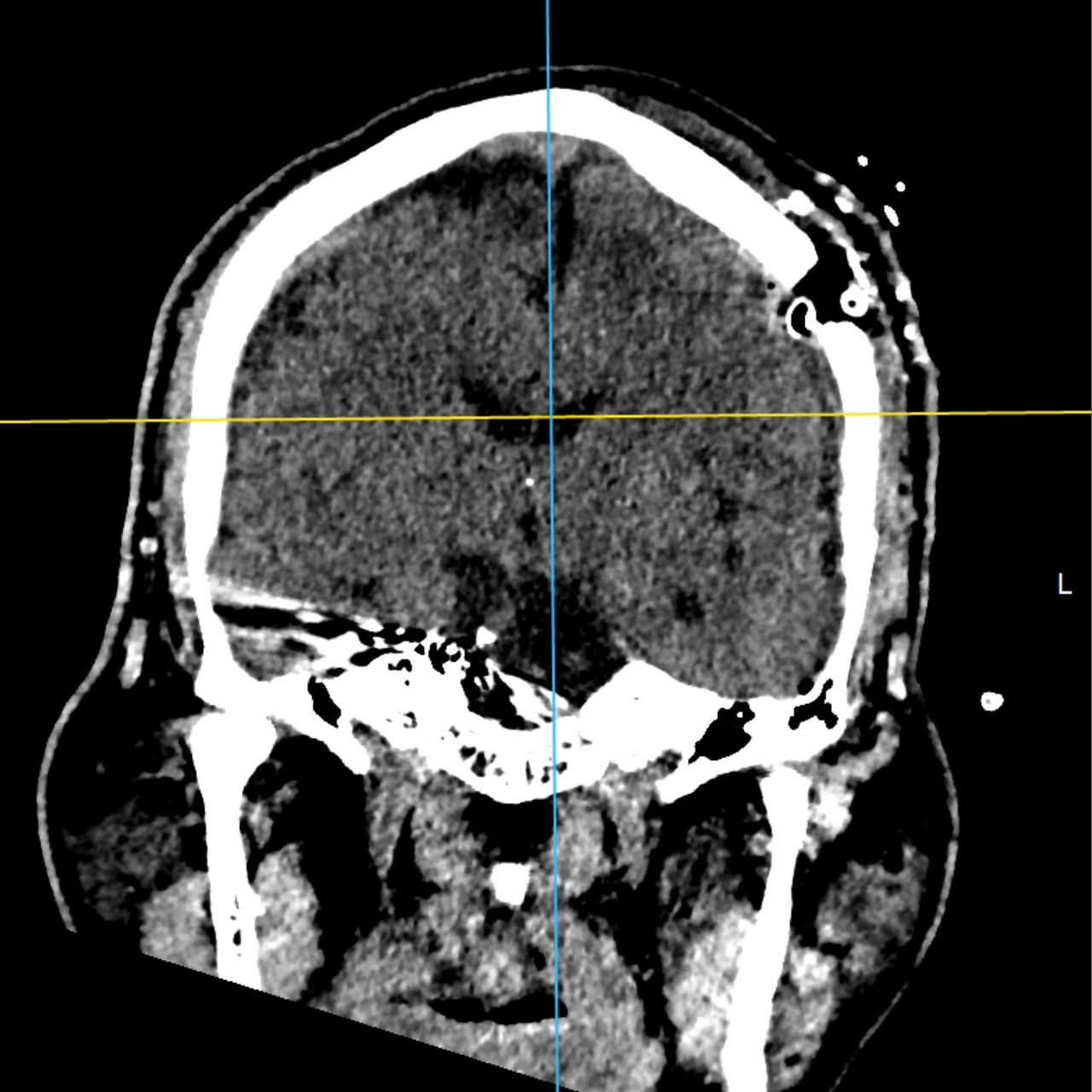 David Tafur Muñoz-2474
