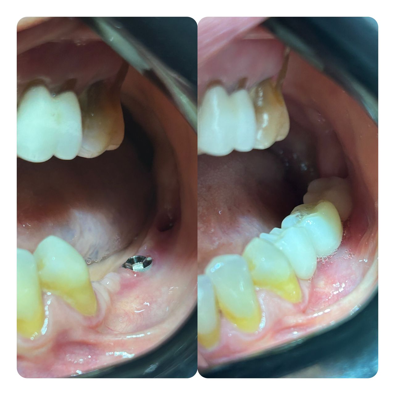 Ana Clara Almeida De Oliveira-0