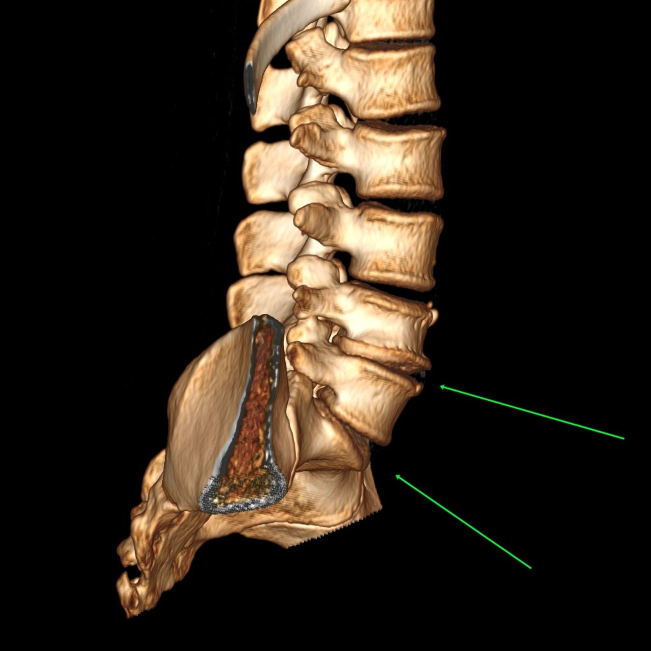 David Tafur Muñoz-1344