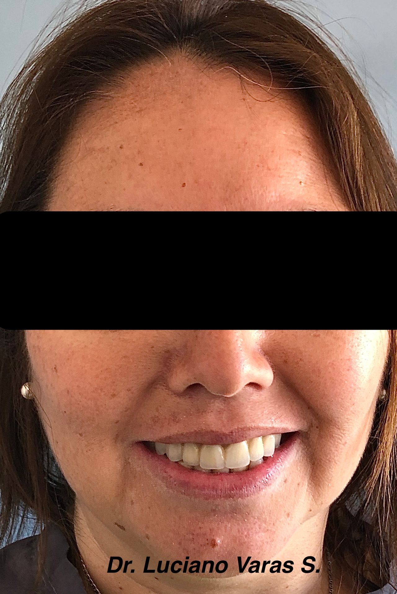 Luciano Varas Salinas-3