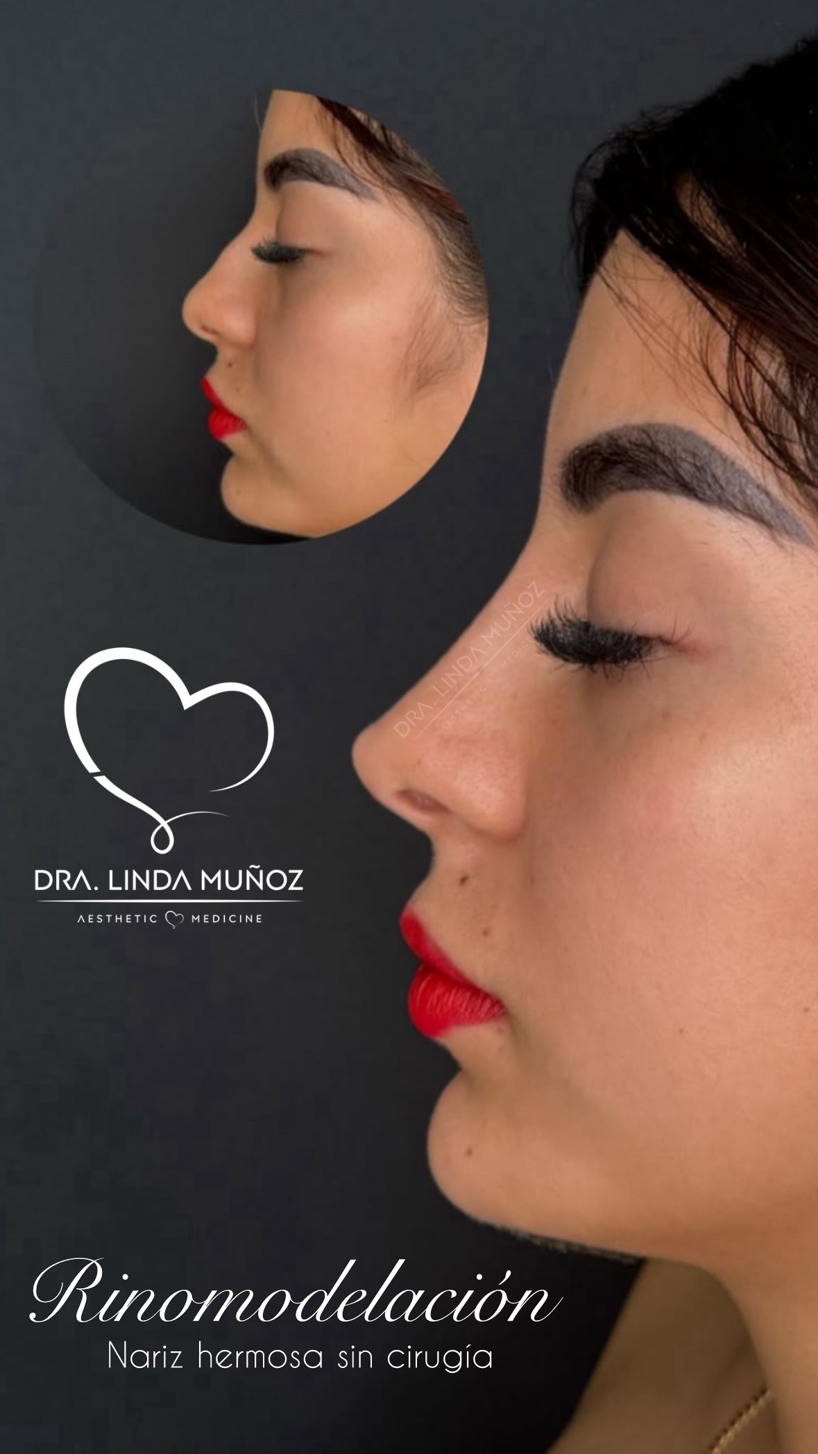 Linda Muñoz-53