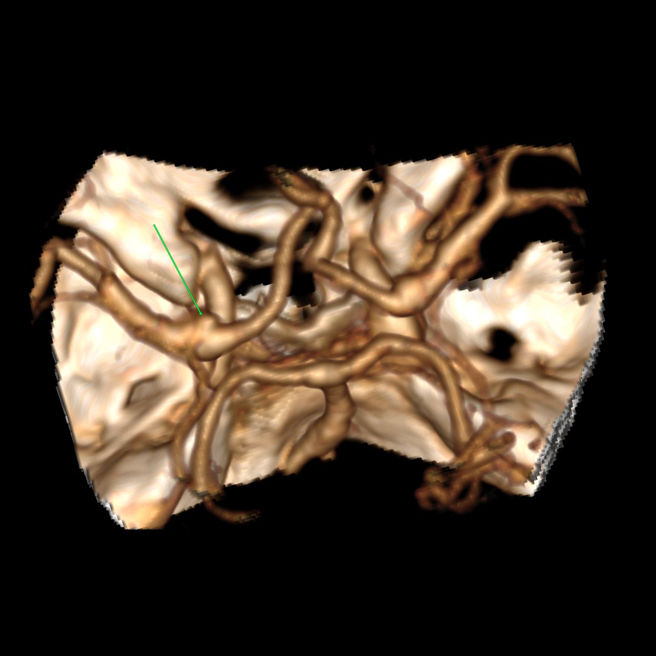 David Tafur Muñoz-1313