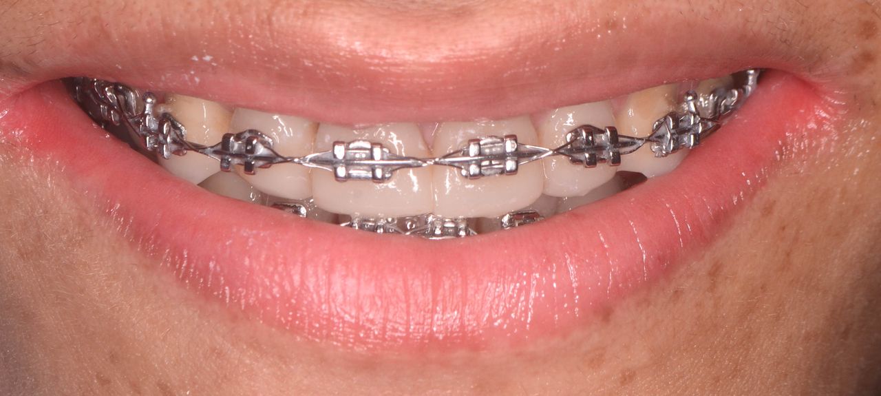 Edith Molina Miranda-14