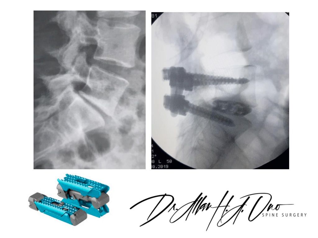 Allan Hiroshi De Araujo Ono-1