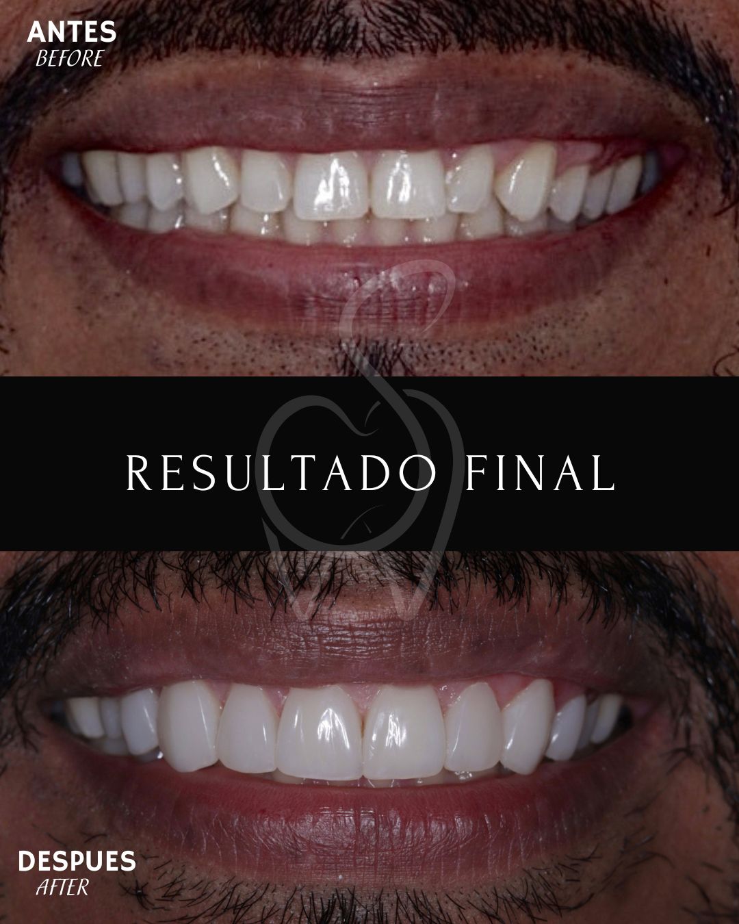 Miguel Dario Charfuelan I.-1