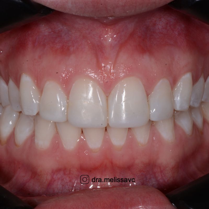 Melissa Vargas Castellanos-5