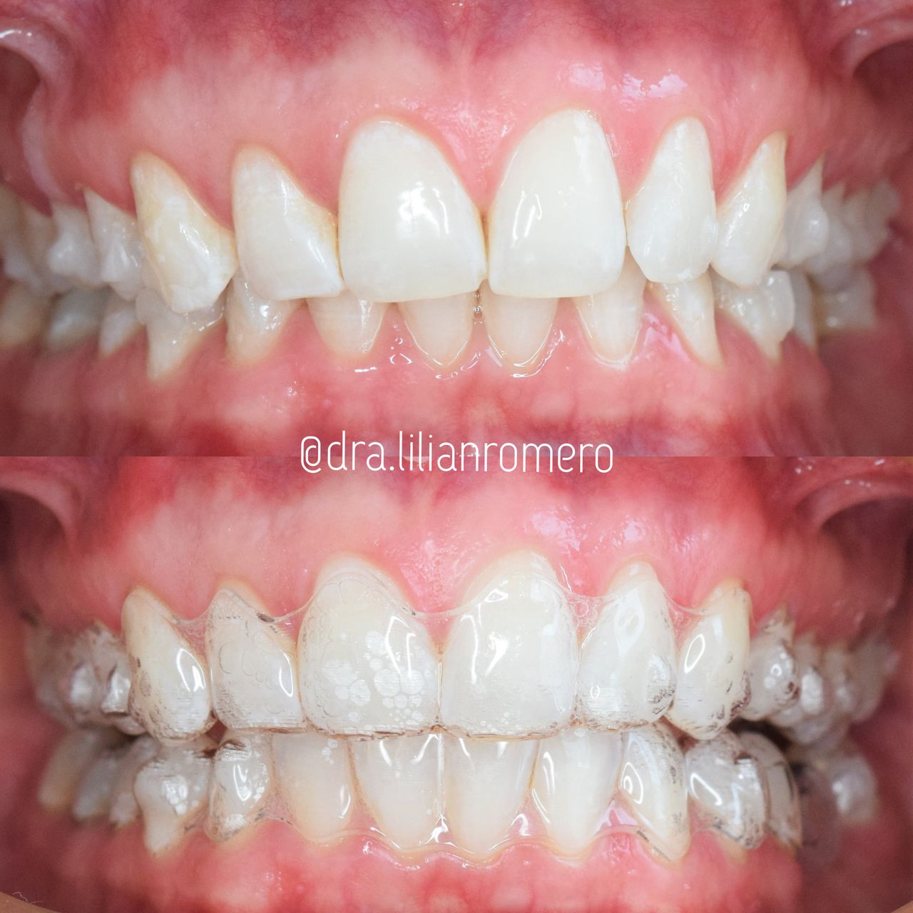 Lilian Catalina Romero Diaz-13