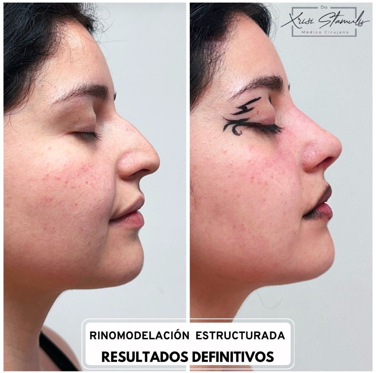 Xrisi Stamulis Rivera-5