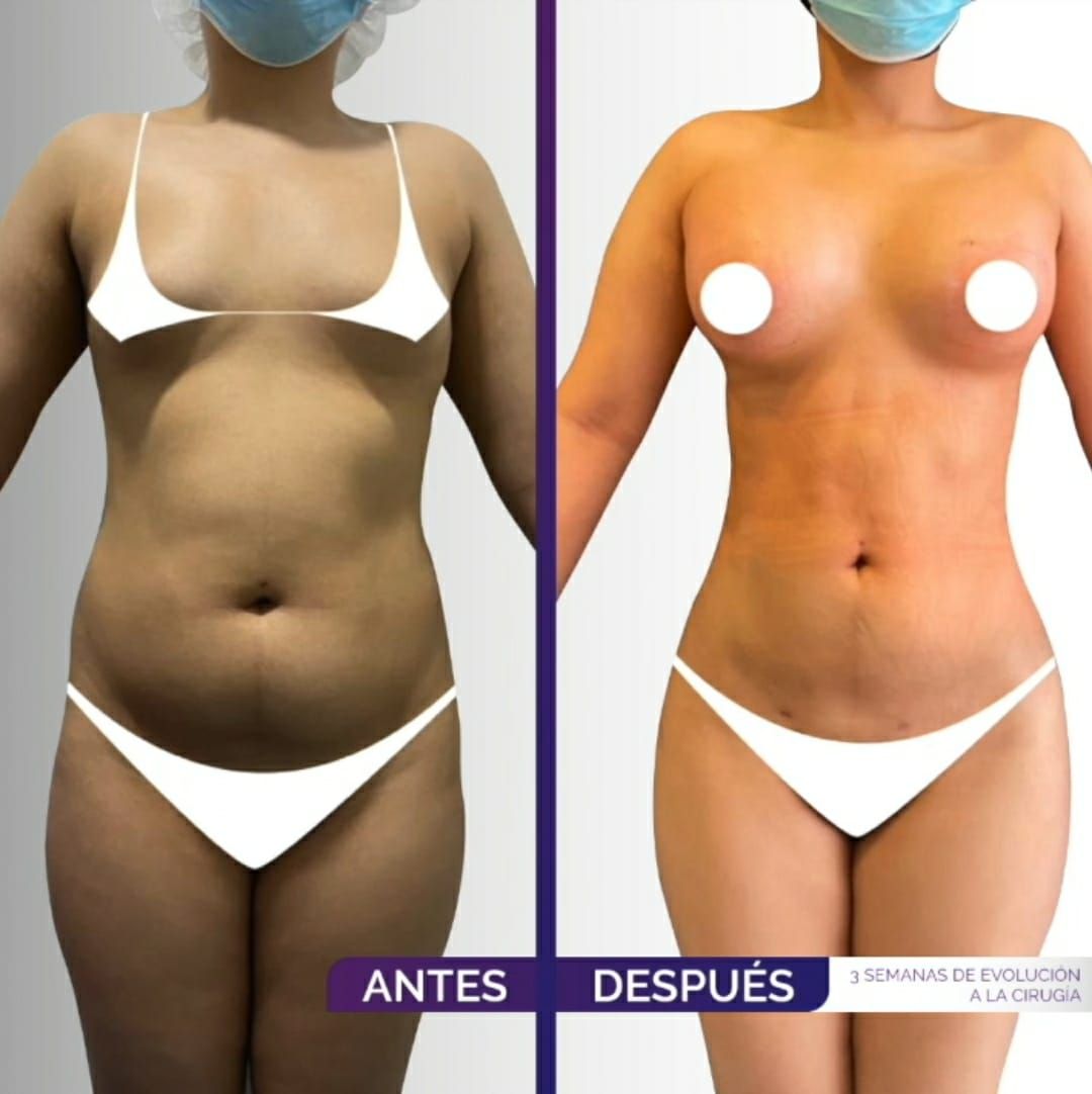 Alexander Mendoza-19