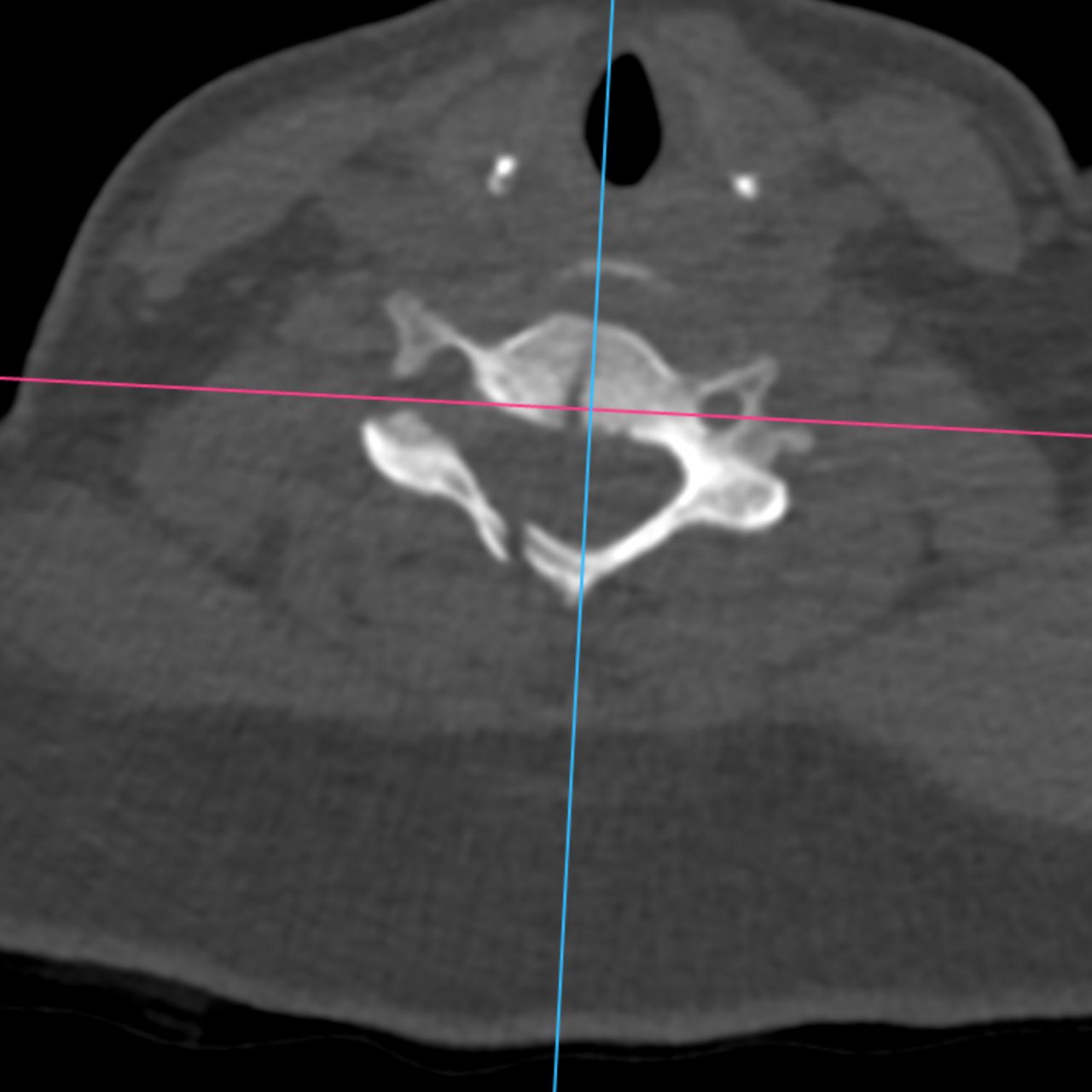 David Tafur Muñoz-2088