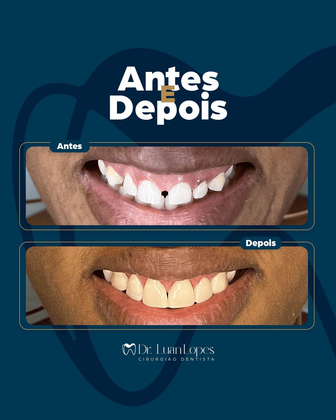 Luanderson Lopes Pereira-6