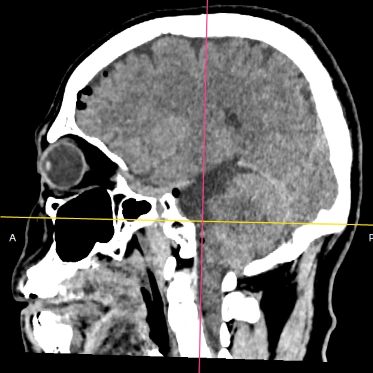 David Tafur Muñoz-1579
