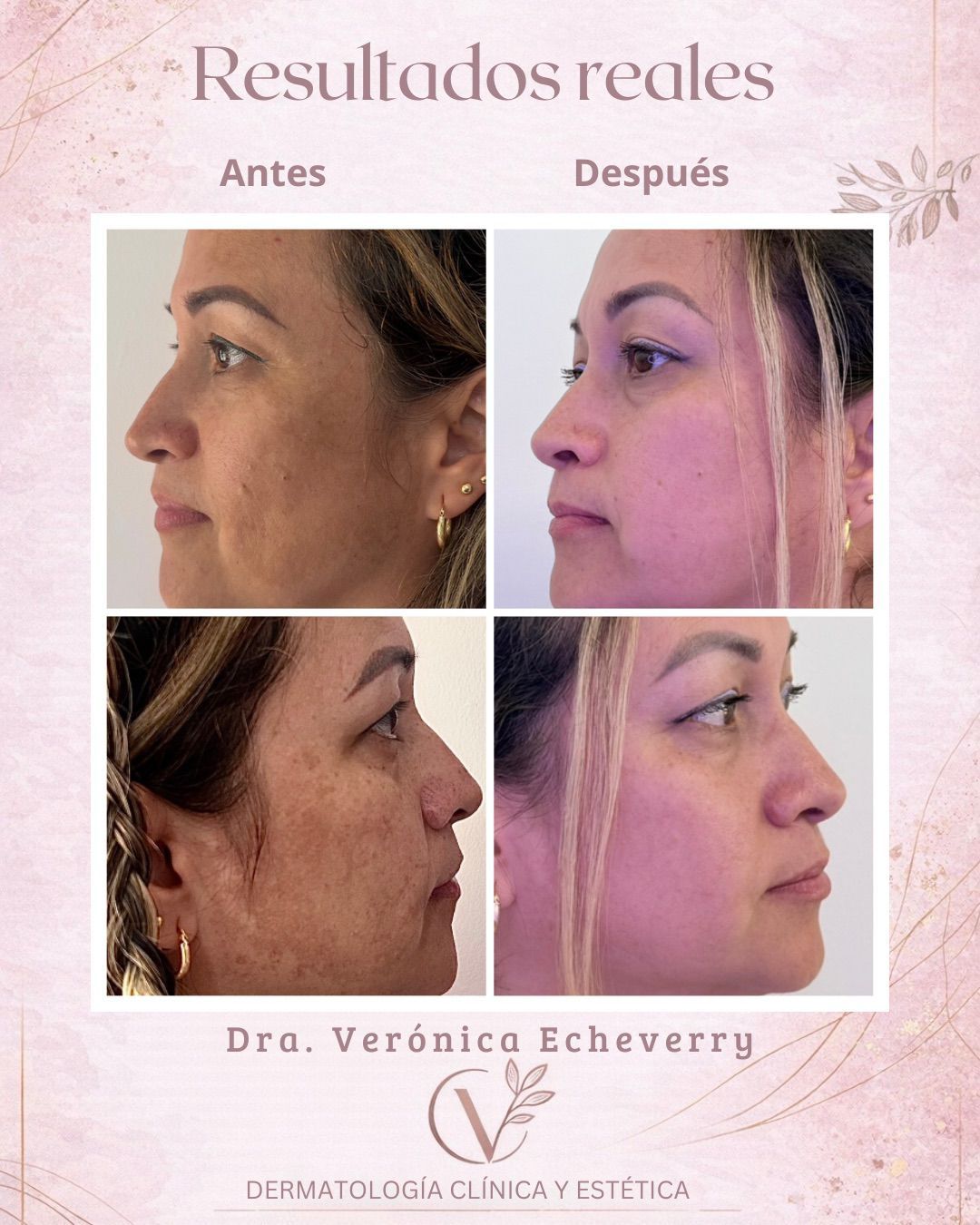 Verónica Echeverry Rodríguez-0