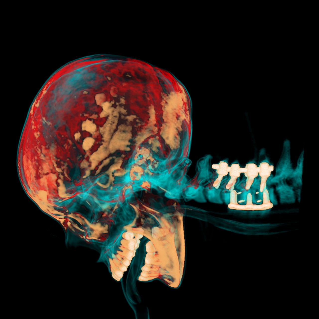 David Tafur Muñoz-1275