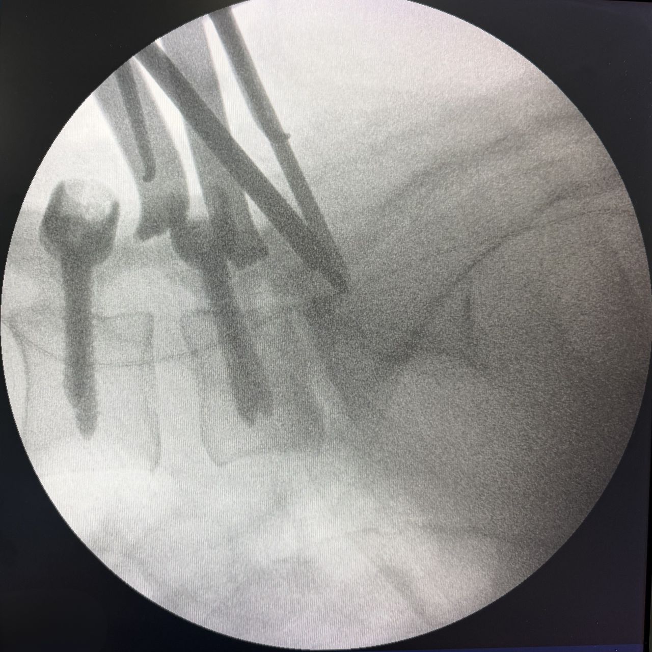 David Tafur Muñoz-2449