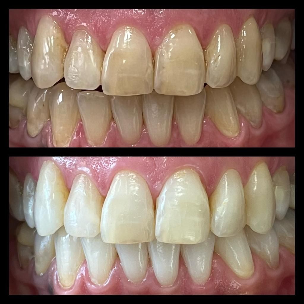 Adriana Souto Nôga .-2