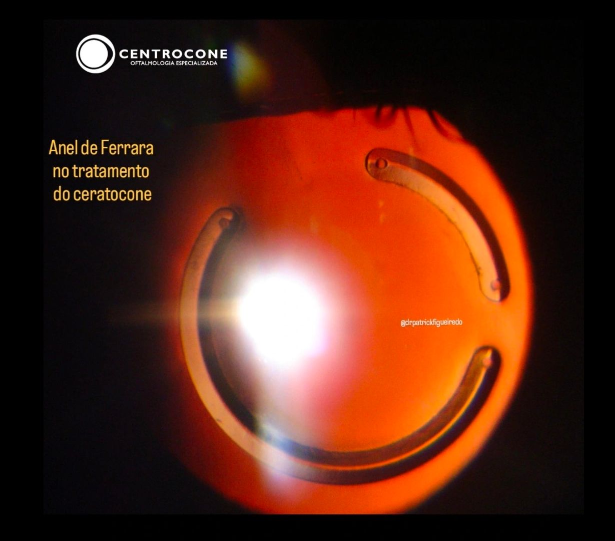 Patrick Figueiredo-1