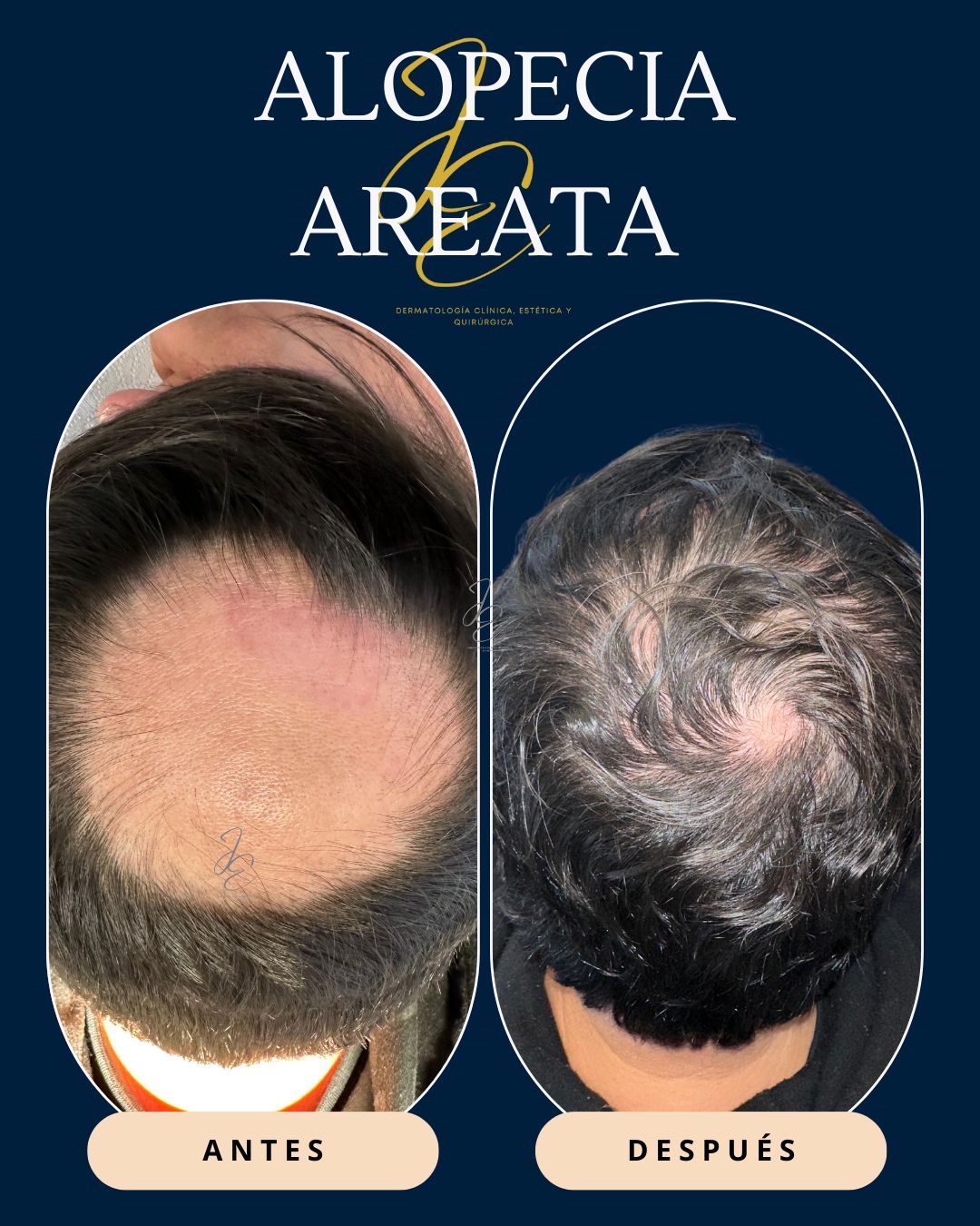 Jeanny Epieyu Diaz-7