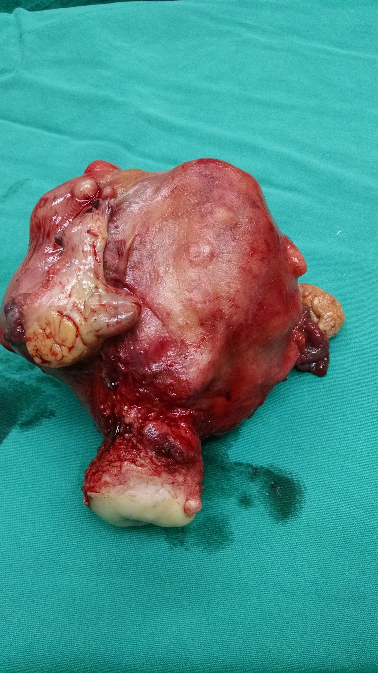 Carla  Lozada Lozada-17