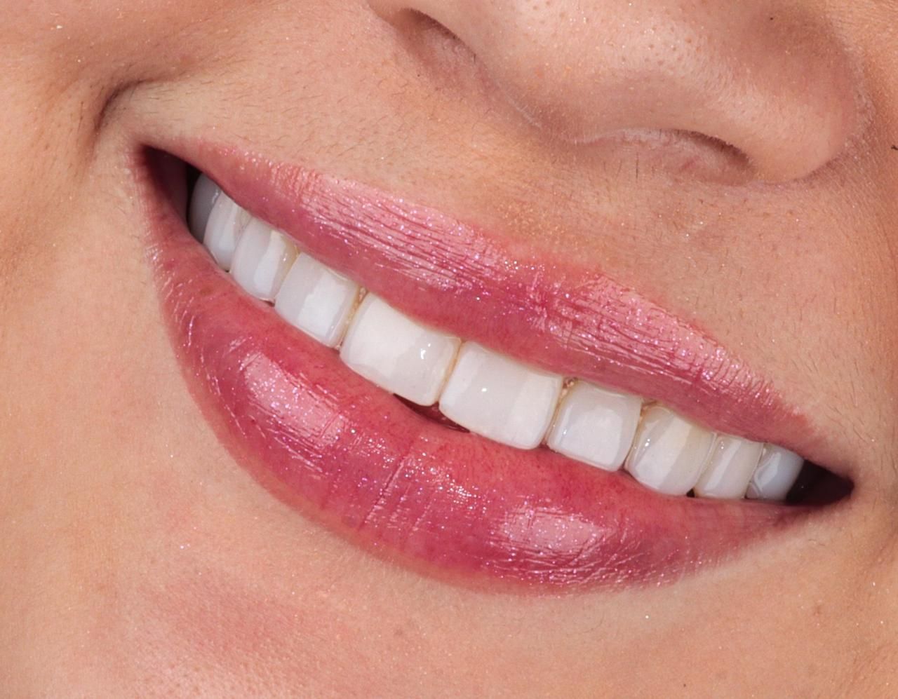 Miguel Angel Ovalle Rivera-1