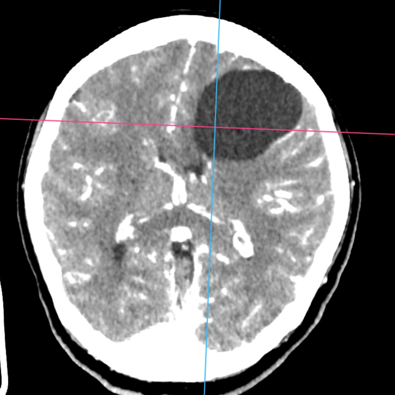 David Tafur Muñoz-1863