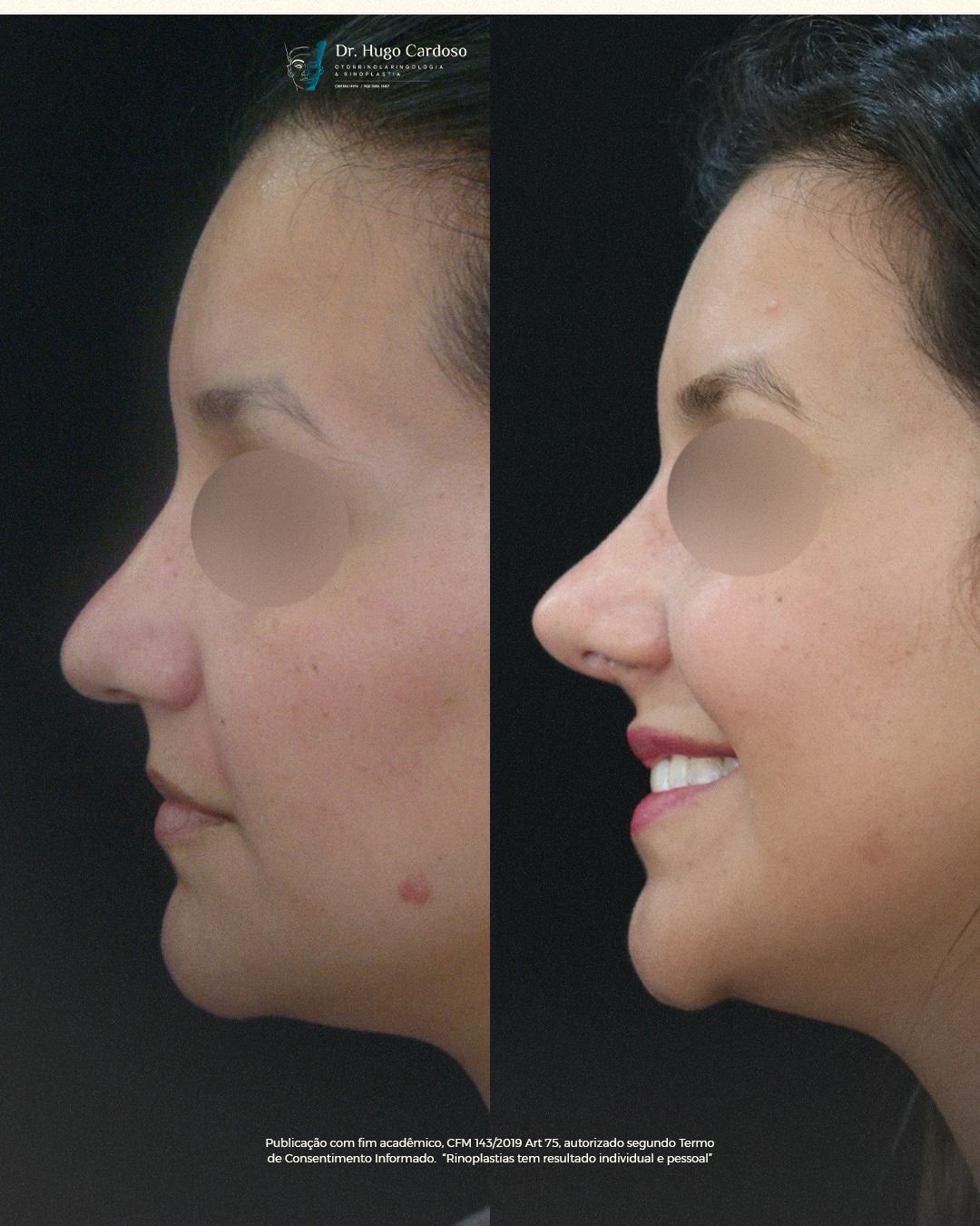 Hugo Cardoso De Oliveira-12