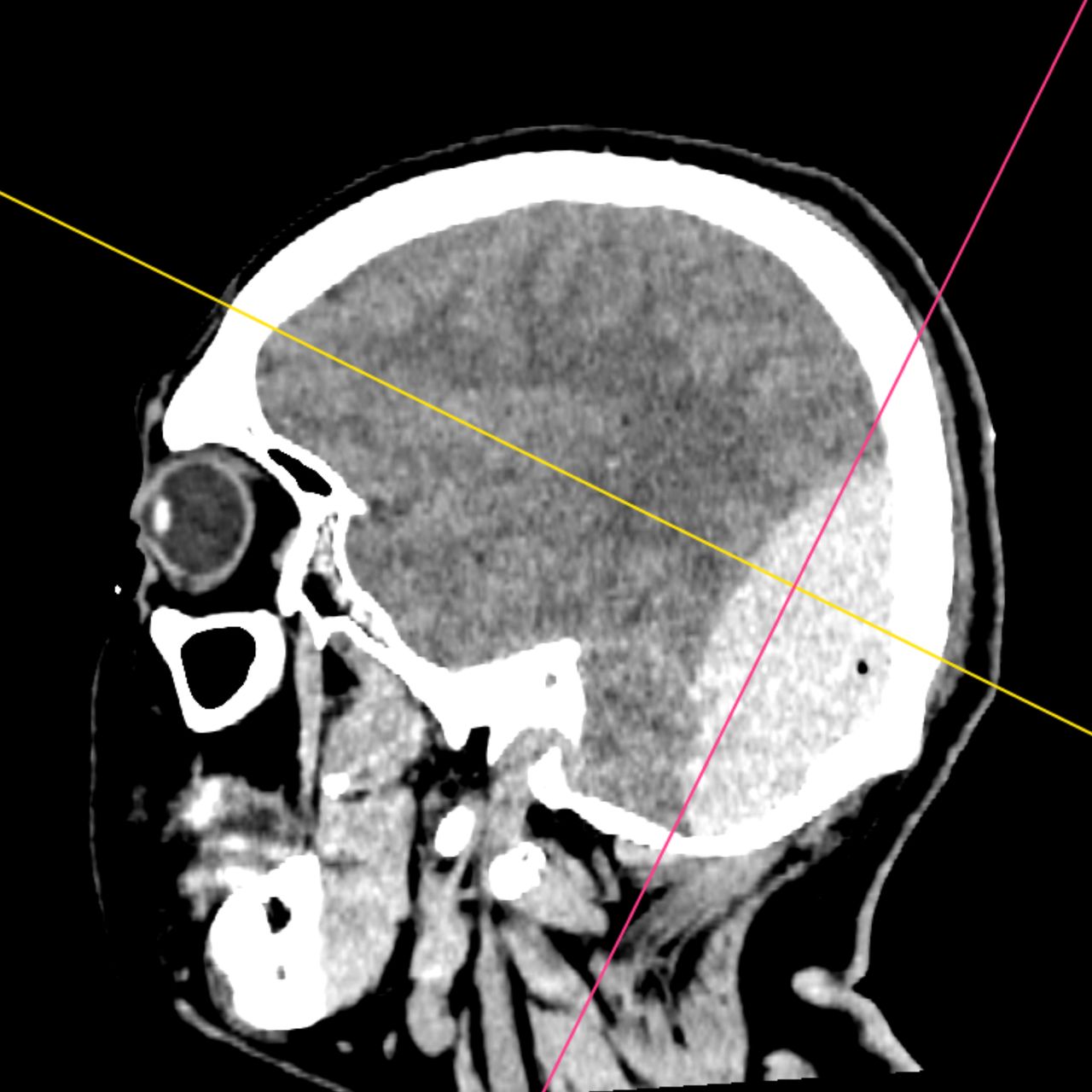David Tafur Muñoz-1691