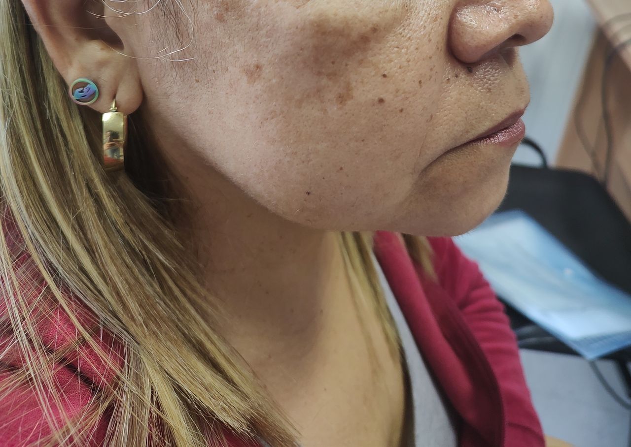 Alejandro Jose  Castellano Parra -1