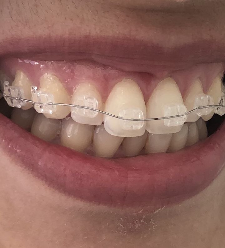 Celia Visentainer Dela Libera-3