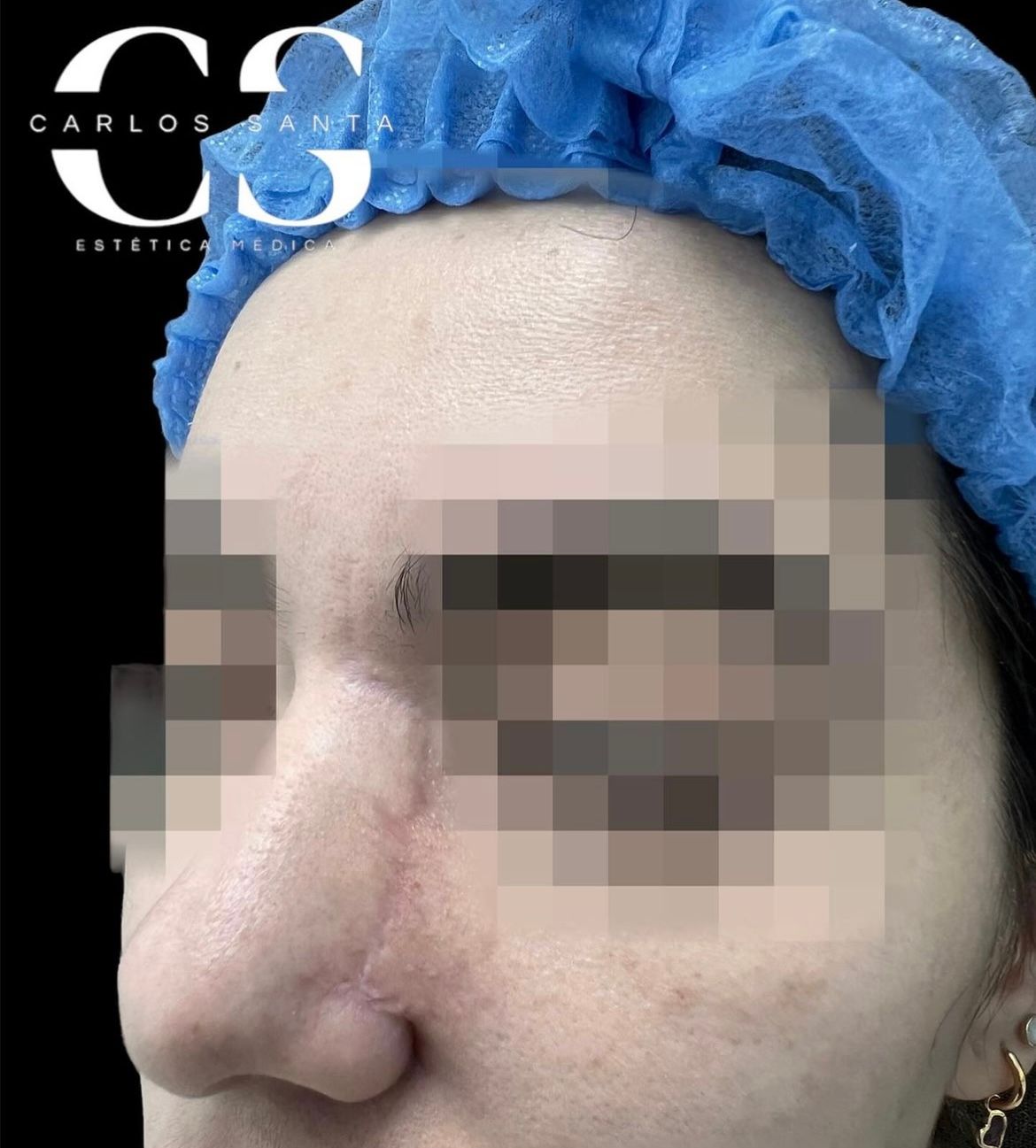 Carlos Andrés Santa-18