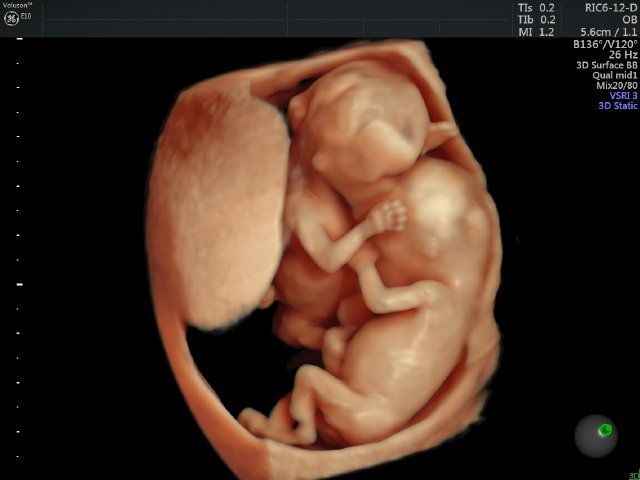 Raul Javier Banderas Pumarino-20