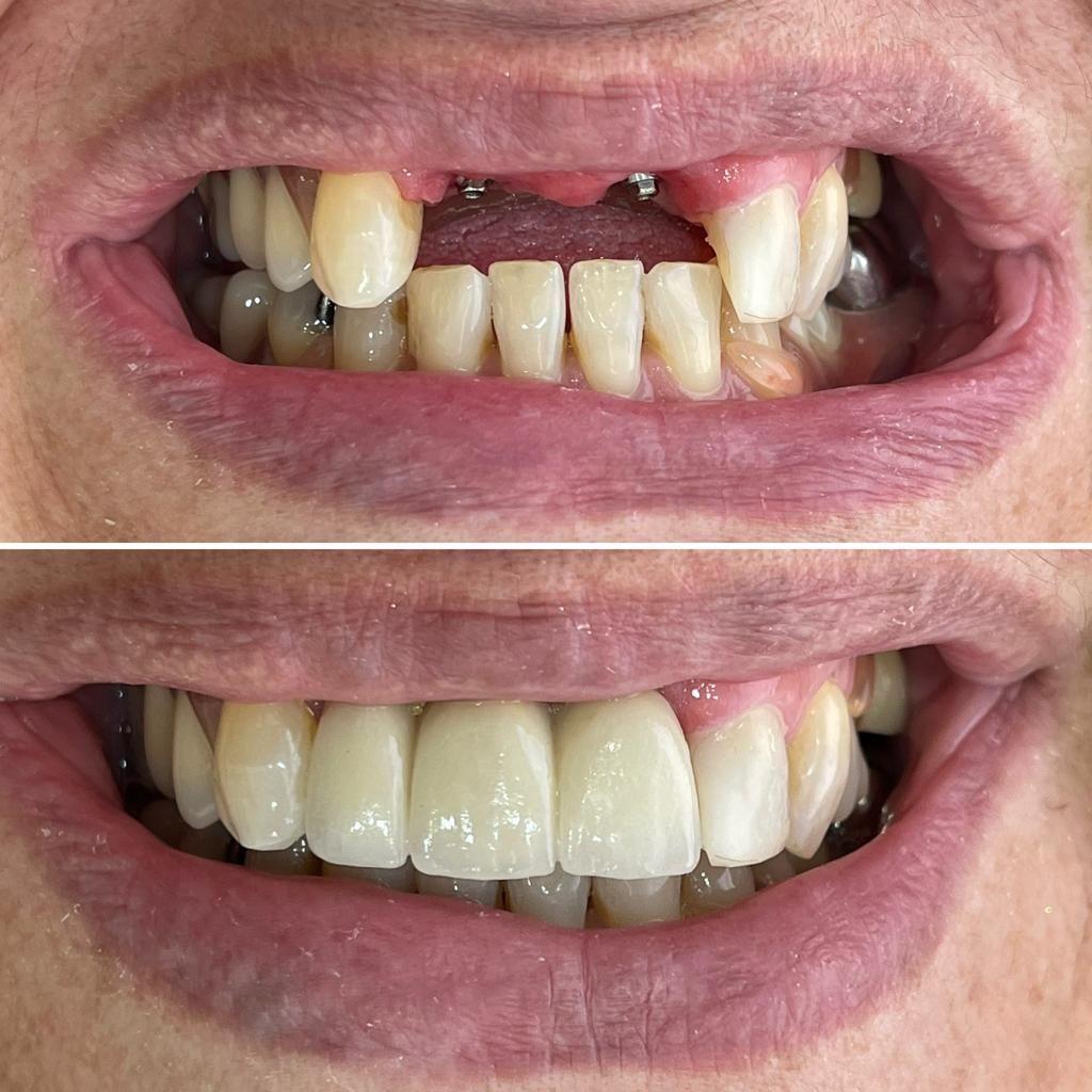 Fernanda Archipéva-13