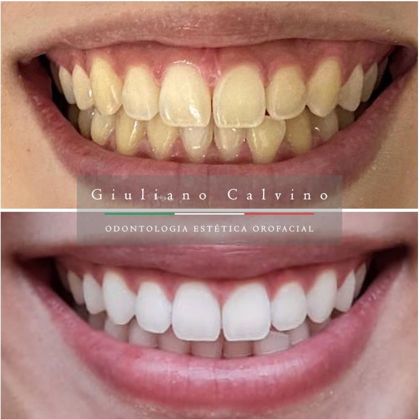 Giuliano  Calvino-15