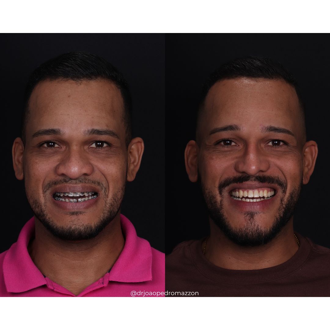 João Pedro Paulino Mazzon-55