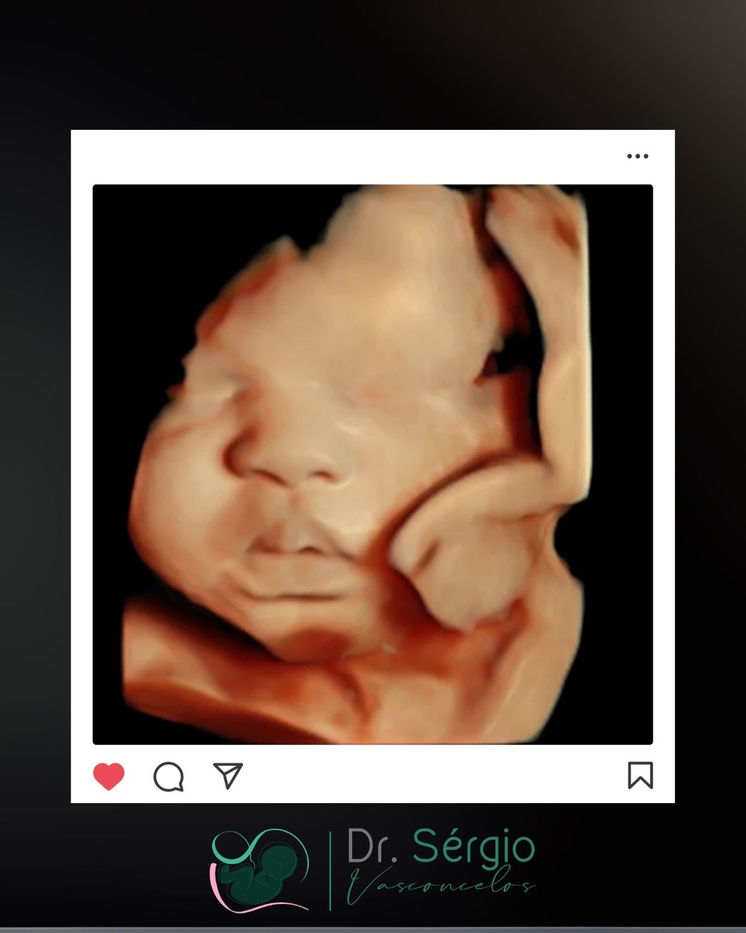 Sérgio De Abreu Vasconcelos Neto-5