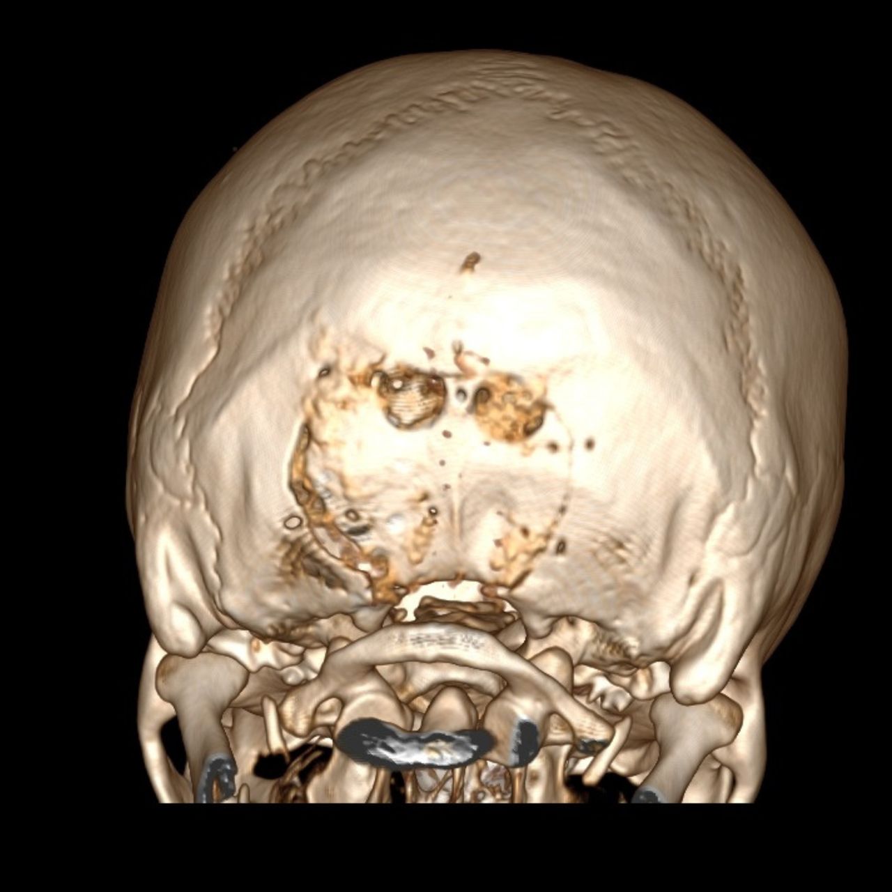 David Tafur Muñoz-1216