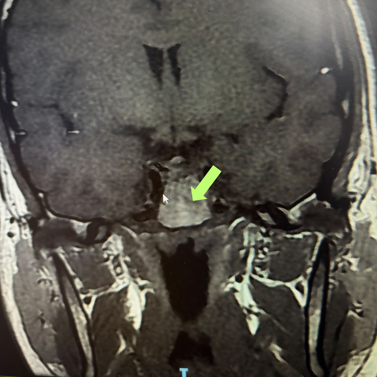 David Tafur Muñoz-2373