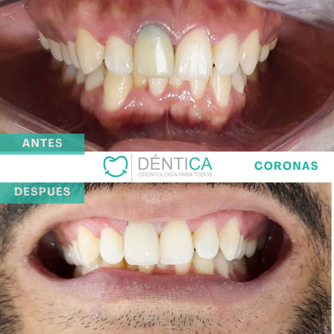 Estefani Canches Caballero-8