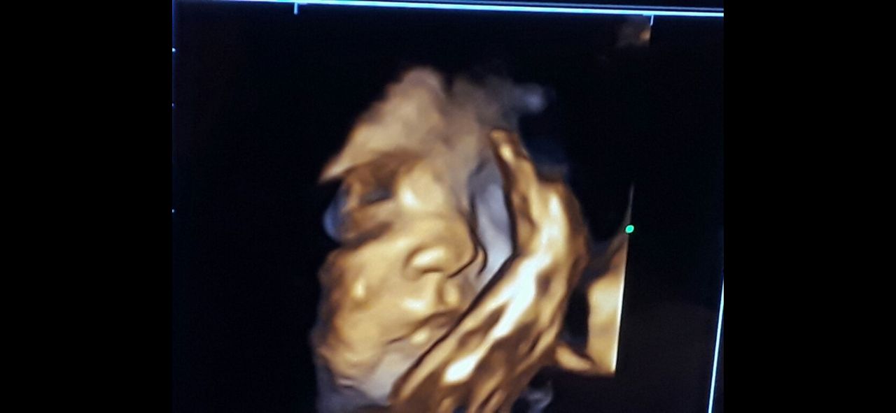 María Denisse Alvarez Huanca-7