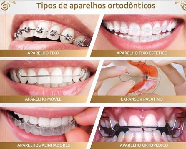 Ana Carolina Junqueira Defina-8