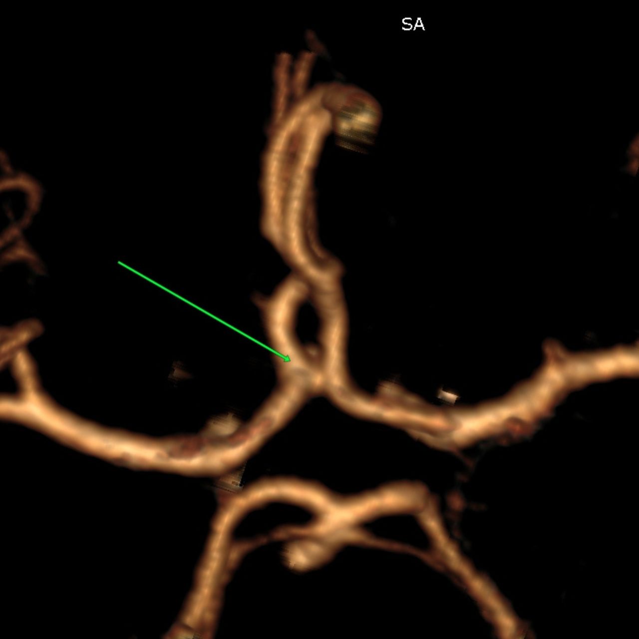 David Tafur Muñoz-1768