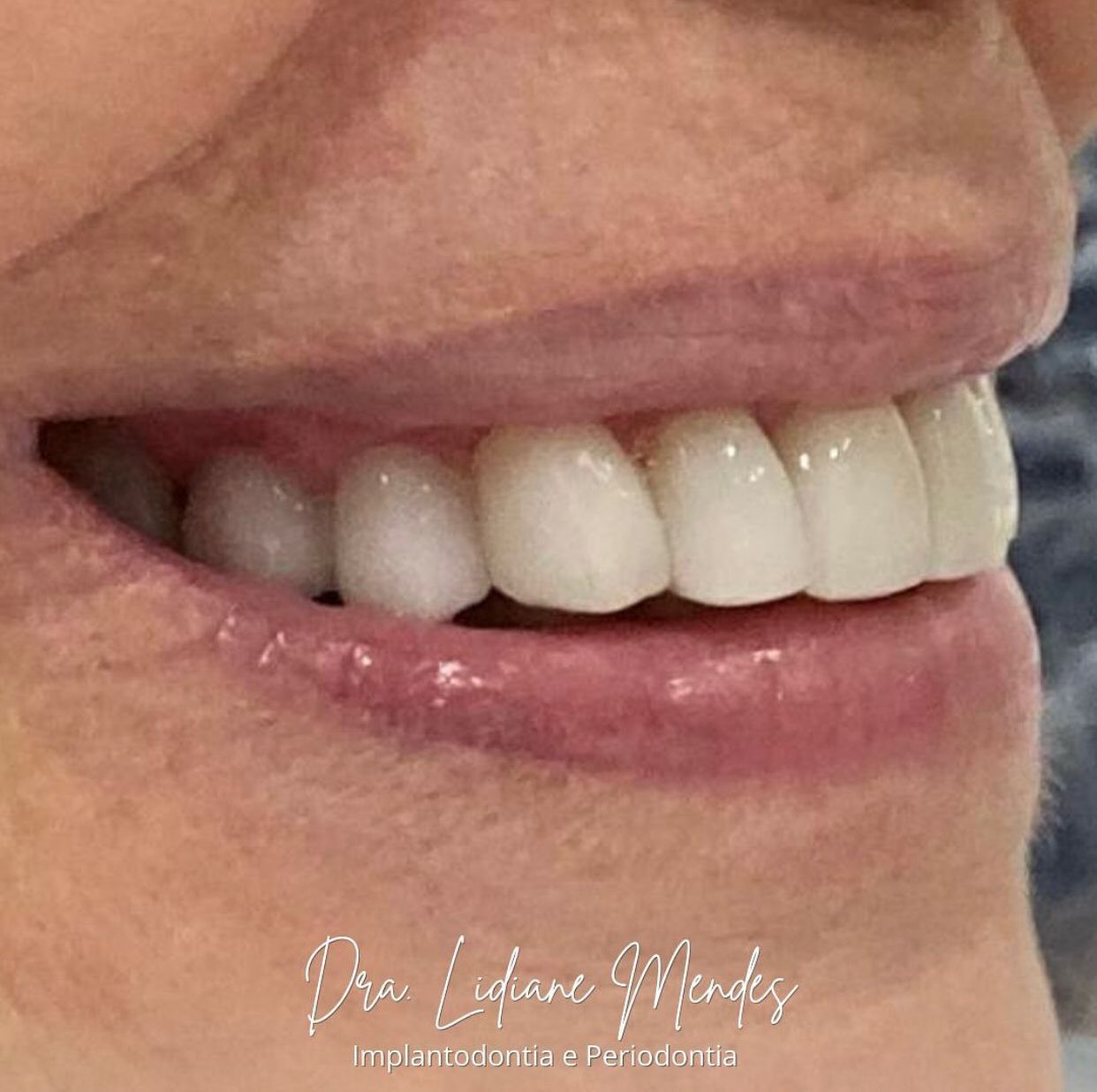 Lidiane Morais Mendes-22