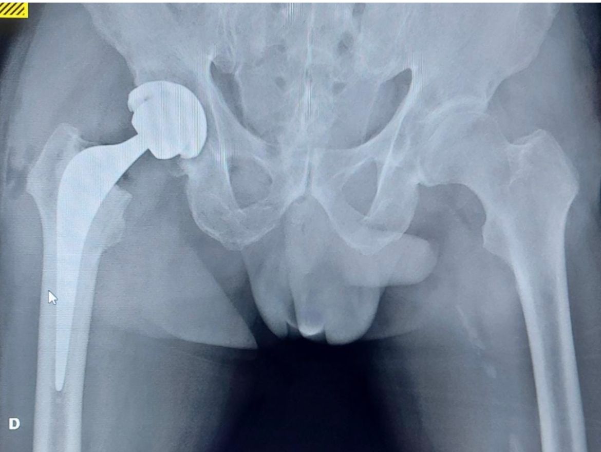 Marcus Vinicius Crestani-7