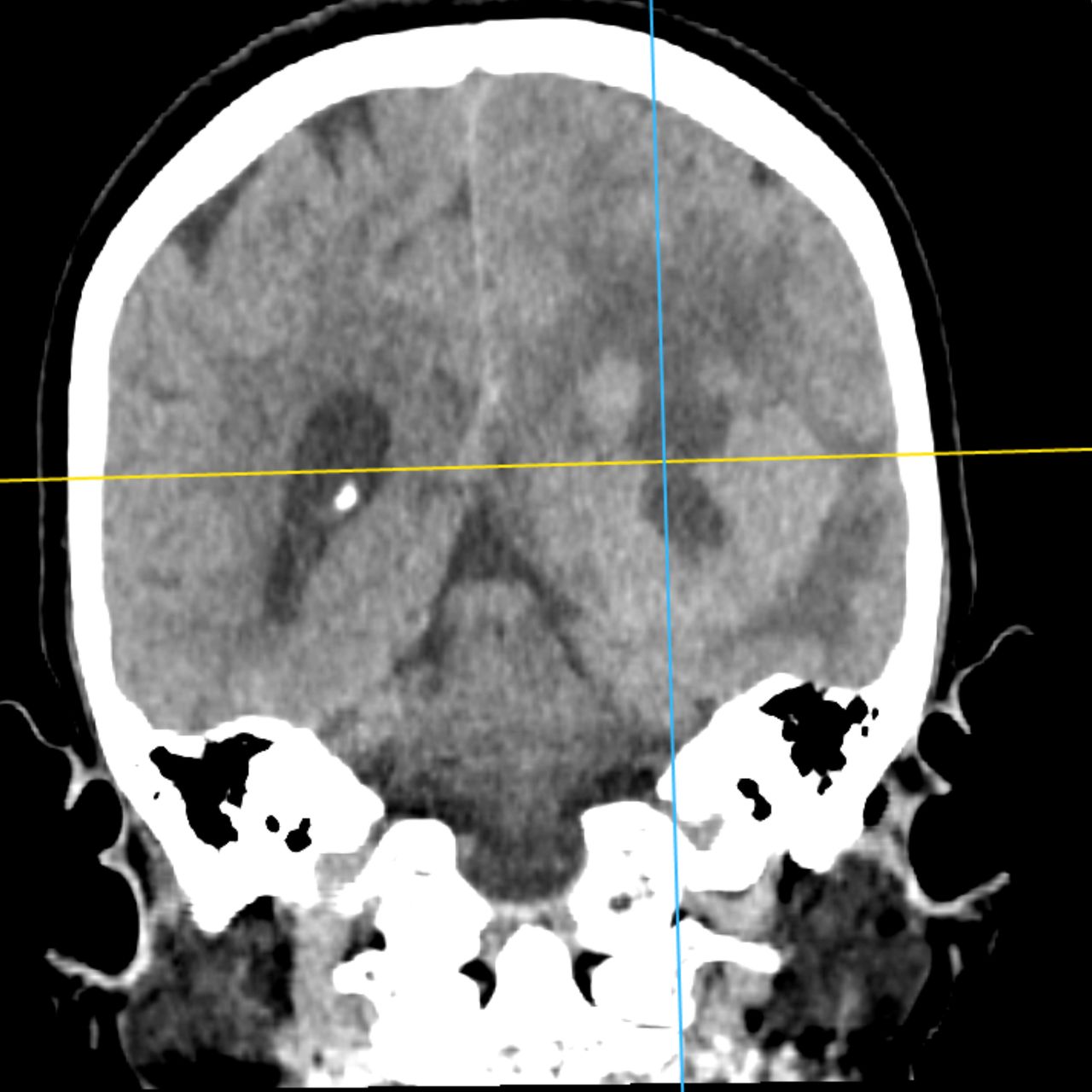 David Tafur Muñoz-1842