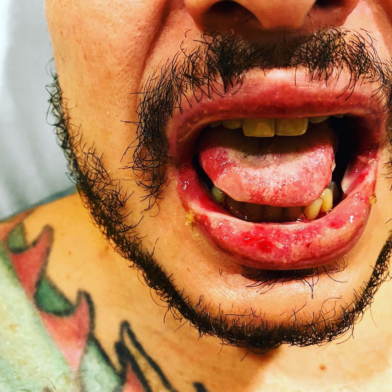 Alexandre Giannini-18