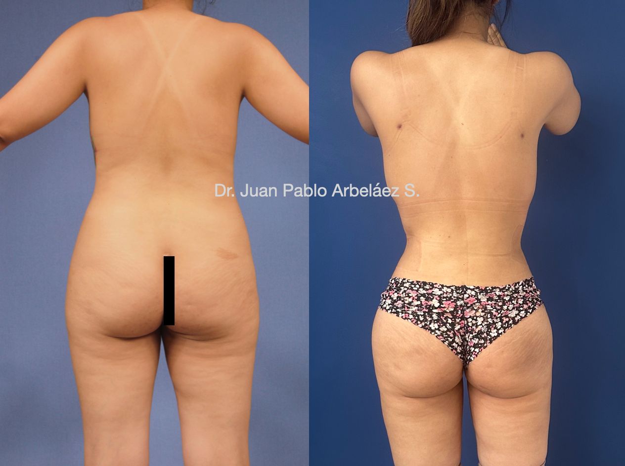 Juan Pablo Arbeláez Sierra-13