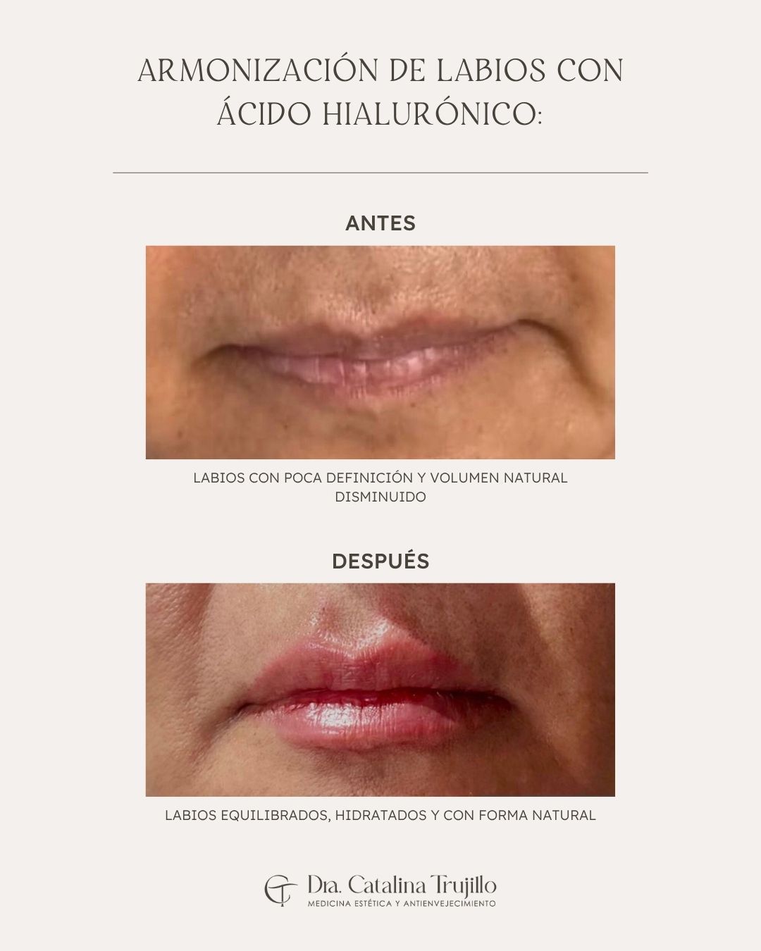 Catalina Trujillo -12