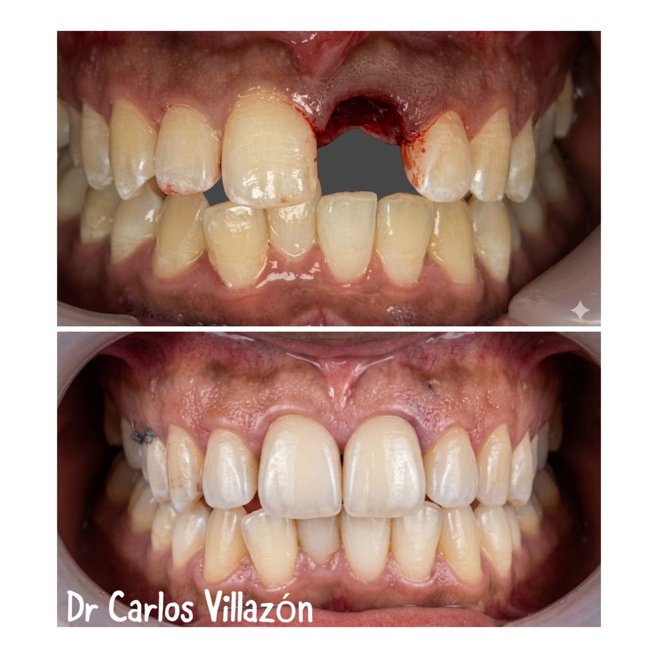 Carlos Andrés Villazón-25
