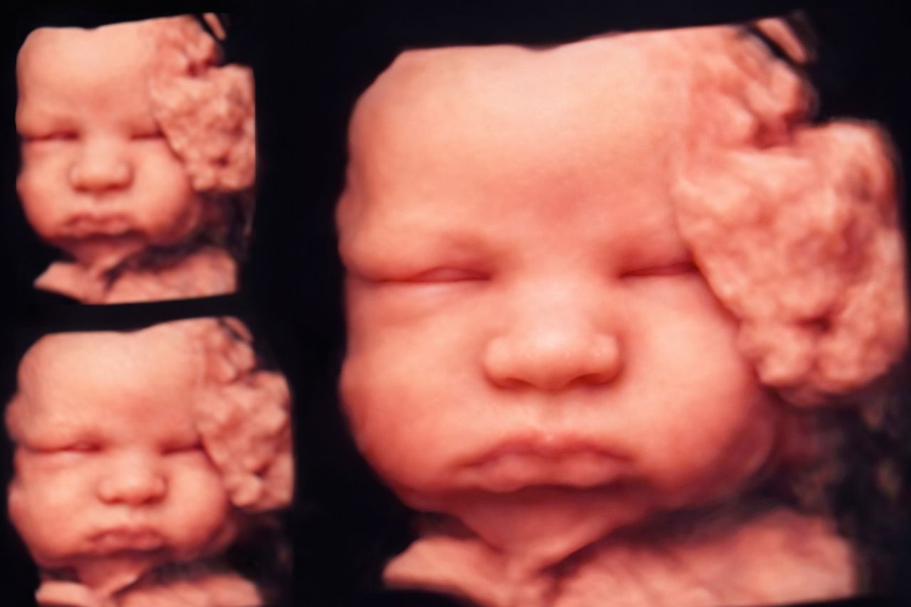 Gontran Tôrres Fróes-2