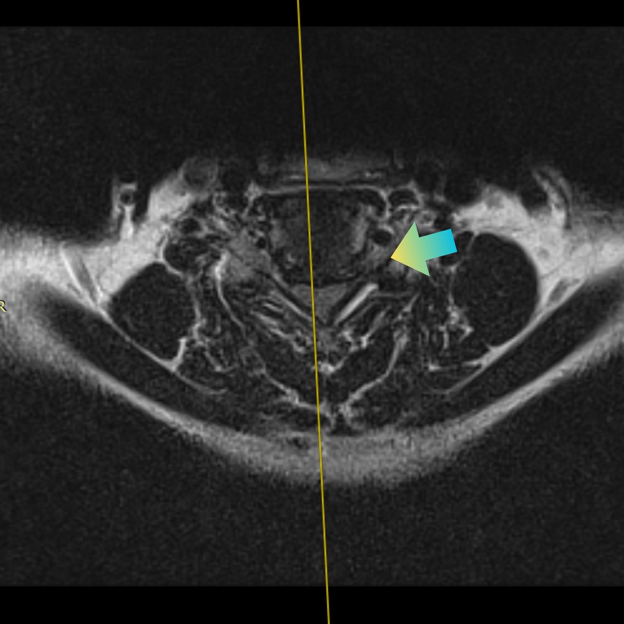 David Tafur Muñoz-2430